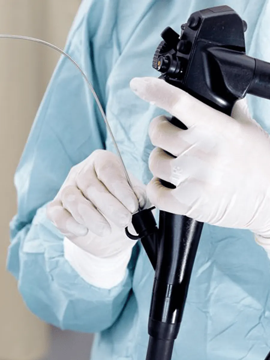 Endoscopia digestiva alta