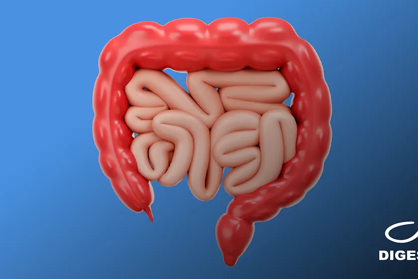Câncer de intestino: o papel da colonoscopia no diagnóstico precoce