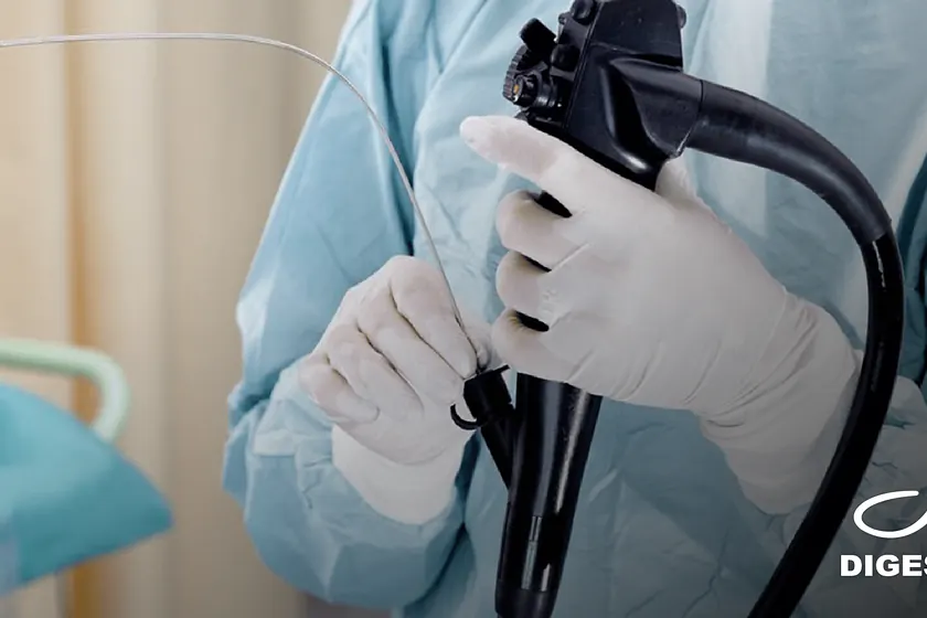Colonoscopia x Endoscopia: entenda as diferenças entre os exames mais comuns da saúde digestiva