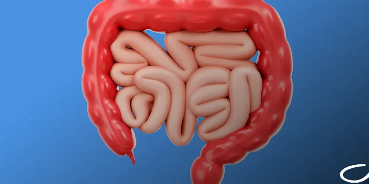 Câncer de intestino: o papel da colonoscopia no diagnóstico precoce